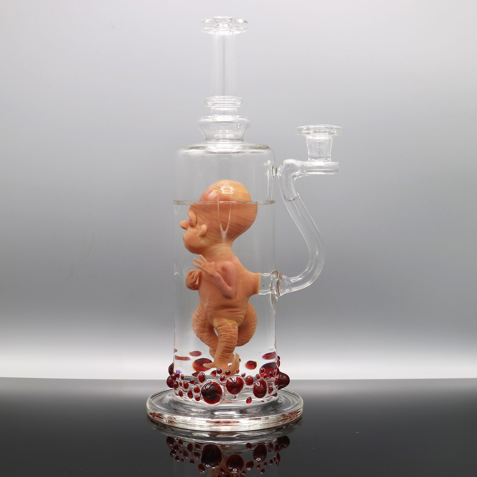 Jonny Carrcass – Thalidomide Fetus in a Bottle