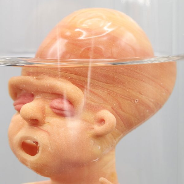 Jonny Carrcass Thalidomide Fetus in a Bottle
