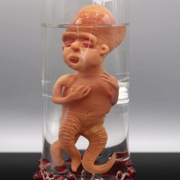 Jonny Carrcass Thalidomide Fetus in a Bottle